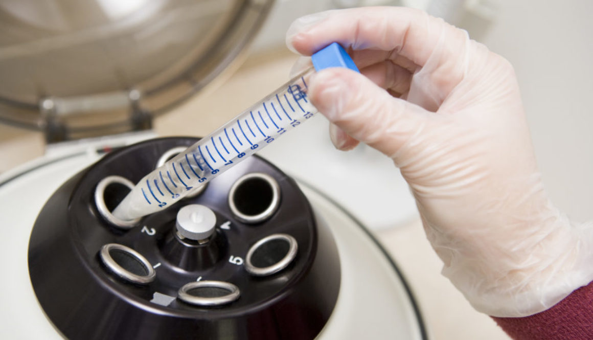 ¿Por qué se adelanta la regla después de una Inseminación Artificial?