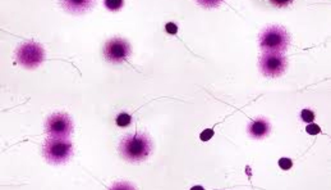 ¿Con una fragmentación espermática del 70% podríamos tener un buen embrión?