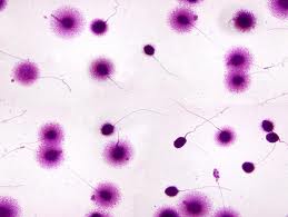 ¿Con una fragmentación espermática del 70% podríamos tener un buen embrión?