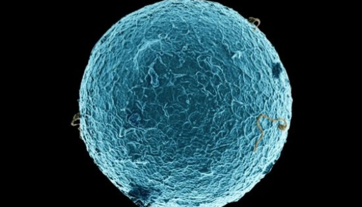 Punción folículos vacíos