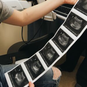 Desarrollo embrionario: Embrión en día 1 (D1)