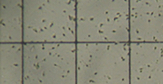 Calidad o cantidad del esperma