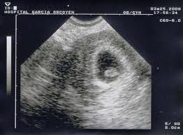 ¿Porqué mi embrión