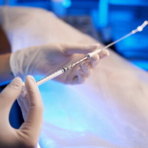 ¿En qué casos se recomienda una inseminación artificial?